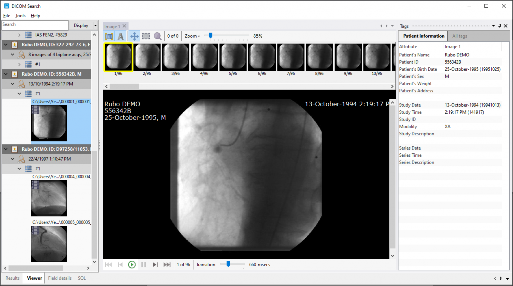 download the new version for android Lim DICOM Viewer
